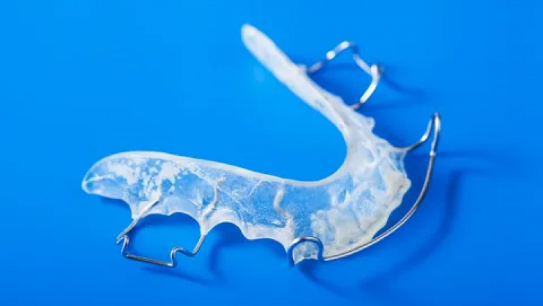 Orthodontic Retainers Market: Regional Breakdown and Forecast of Sales Across Global Economies