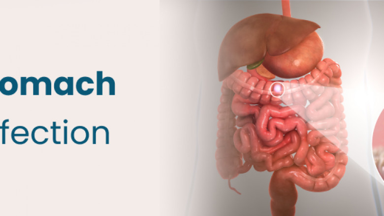What Causes Stomach Infections? Common Triggers and Risk Factors