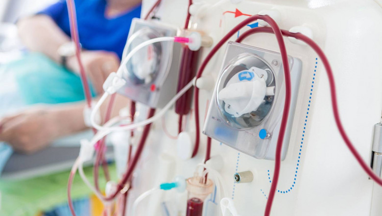 How China's Aging Population Is Reshaping Its Dialysis Market in 2025