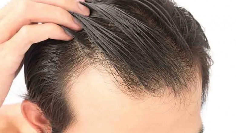 Cold Peel: Smooth Skin Naturally
