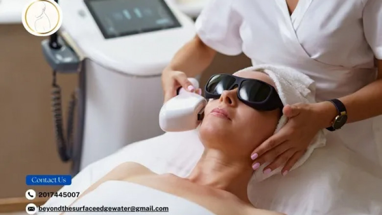 Unlock Healthy Skin: How Laser Therapy Restores Confidence and Removes Stretch Marks