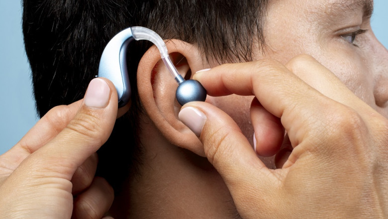 Cochlear Implants Market Size, Company Profiles, Emerging Technologies, and Demand by 2034