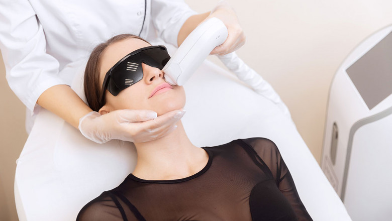 How Does Laser Hair Removal Address Hormonal Hair Growth?