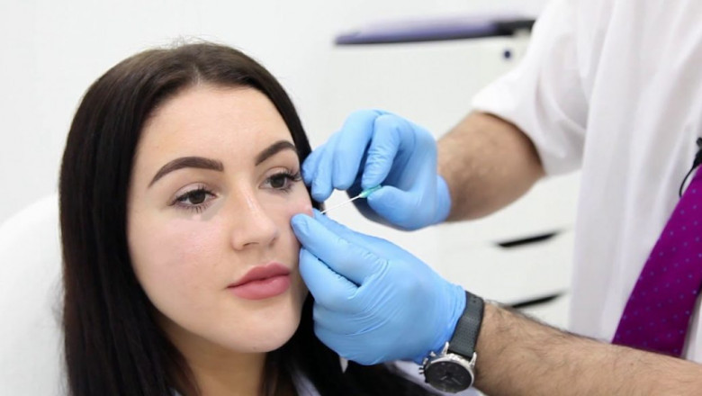 Tear Trough Filler: The Ultimate Solution for Tired, Hollow Eyes