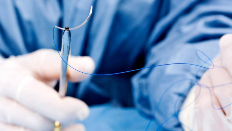 Dental Suture: An Overview of Common Suturing Techniques Used in Dental Procedures