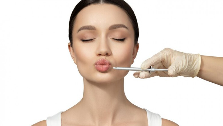How Do Lip Fillers Injections Enhance Shape?