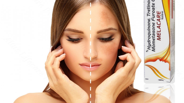 Melacare Skin Cream The Hidden Miracle for Perfect Skin