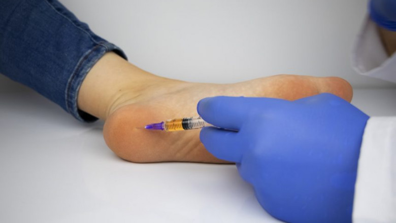 Acute Gout Flare Therapeutics Market to Soar with Biologic Innovations