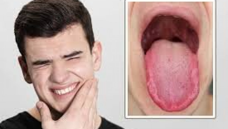 Burning Mouth Syndrome Testing Market: Emerging Trends and Diagnostic Advances