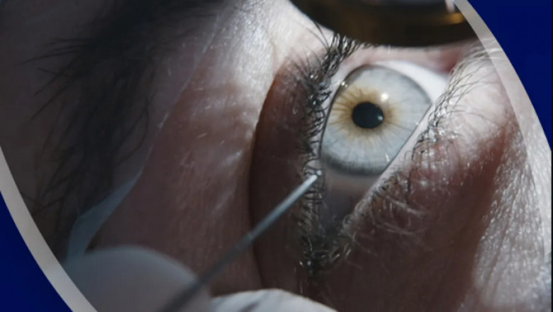 Eye Correction Doctor: Your First Step Toward Clear Vision