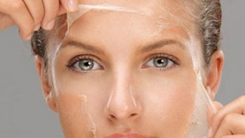 Is It Painful to Get a Chemical Peel in Dubai?