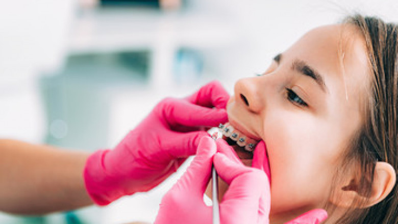 The future of tooth straightening: smiles re-imagined
