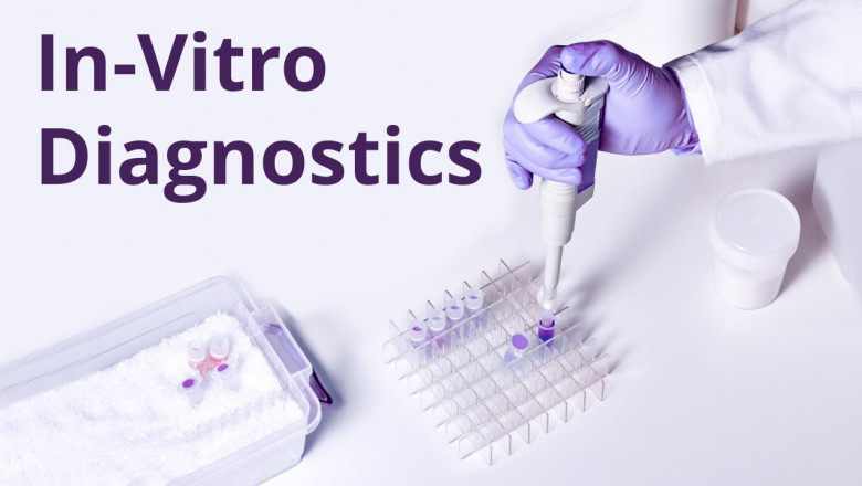 Top 7 Growth Drivers of Norway In-Vitro Diagnostic Market by 2030