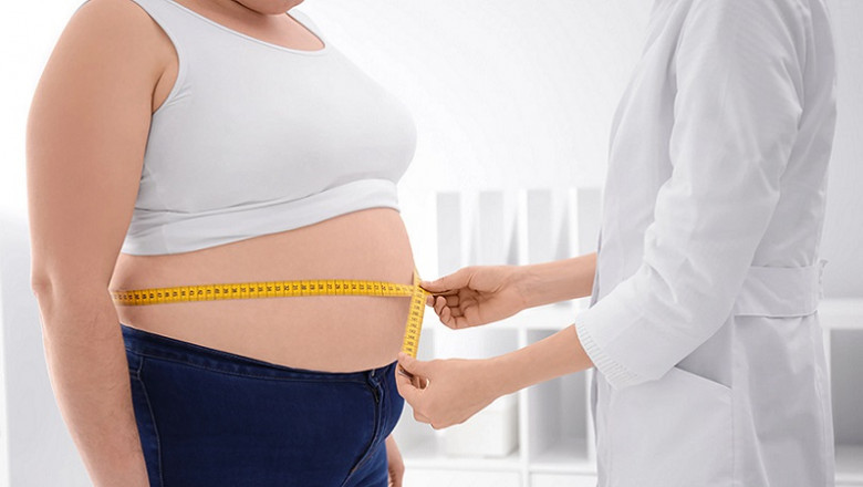 What Impacts Bariatric Surgery Cost and How to Lower Yours