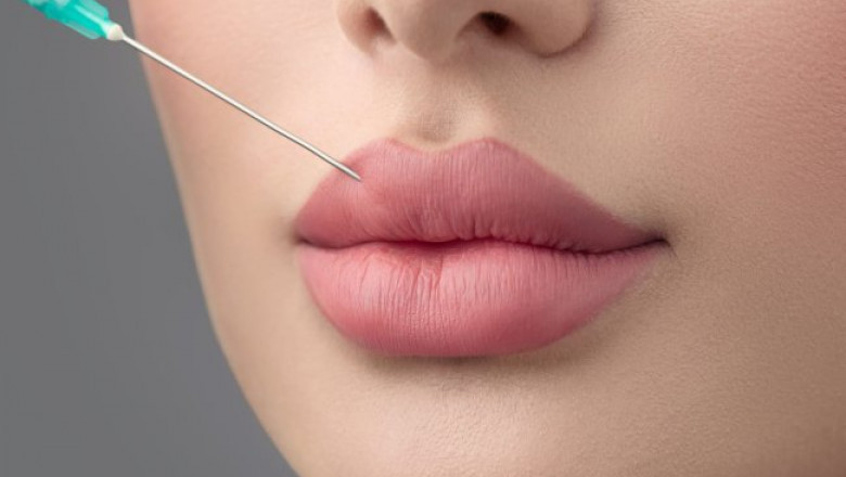 Best Aesthetic Clinic in Dubai: Offering the Best Care and Results for Russian Lip Fillers