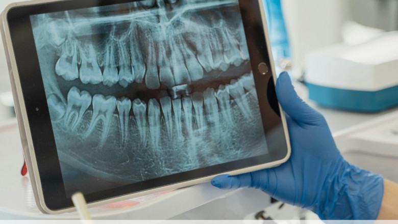 Dental Tips for Seniors: Maintaining Oral Health Over 60