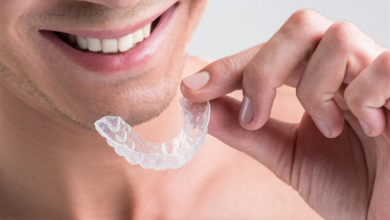Honest Review of Invisalign Braces Treatment: Understanding Its Value