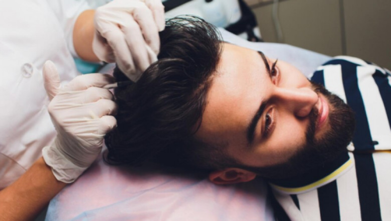 How Safe Are Modern Hair Replacement Procedures?