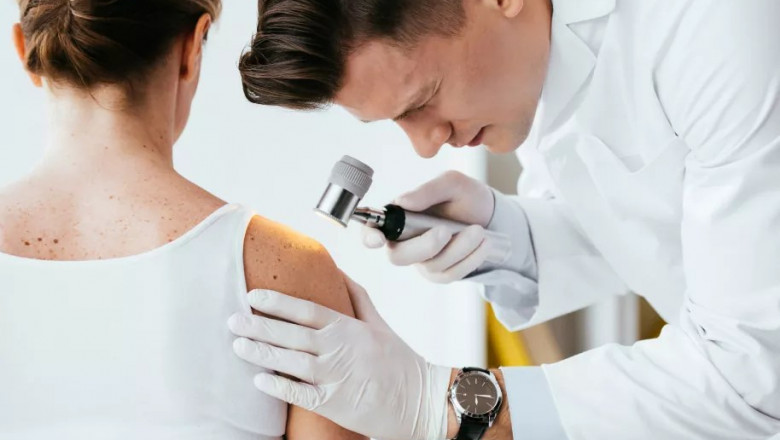 How to Choose the Right Dermatologist