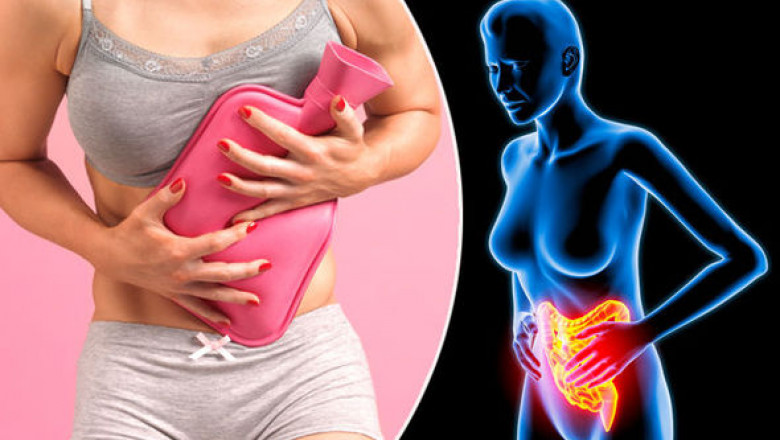 Natural Treatments for Crohn’s disease - Philadelphia Holistic Clinic