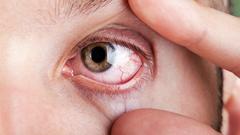 Why Your Vision Blurs After Too Much Screen Time And How to Fix It?
