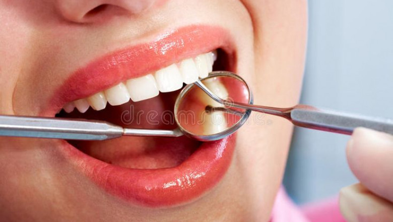 Affordable Dental Check-Ups