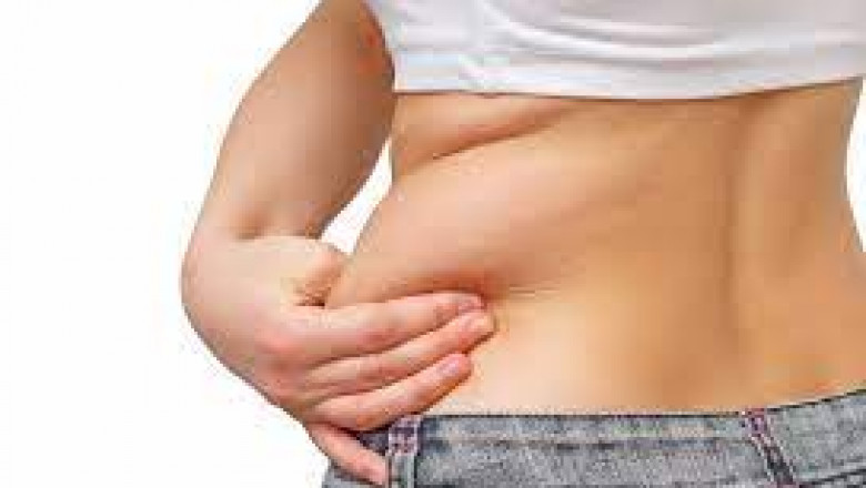 Choosing the Right Surgeon for Liposuction: What to Look For
