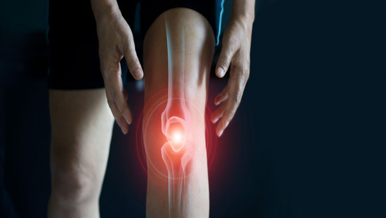 Knee Osteoarthritis Market is Estimated to Witness Growth Owing to Nanotechnology Therapeutics
