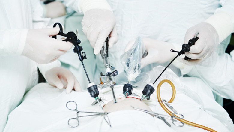 Laparoscopic Devices Market Growth: Assessing Impact of Increasing Surgical Volume and Aging Patient Population