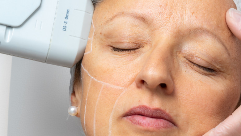 The Best Non-Surgical Skin Tightening for Men: HIFU Explained