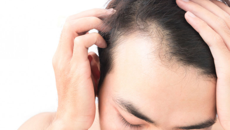 Front Line Hair Fixing Journey