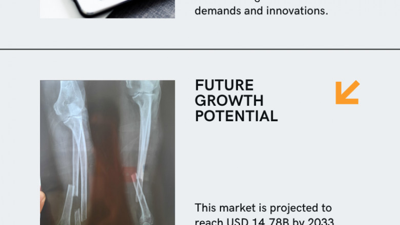 Trauma Fixation Device Market Insights 2025-2033| Growth &amp; Opportunity Analysis
