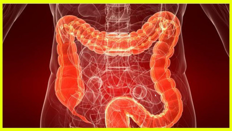 UK Ulcerative Colitis Market to Grow Due to Biologics