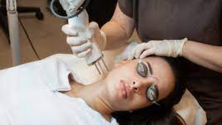 What to Expect During Your First PICO Laser Session