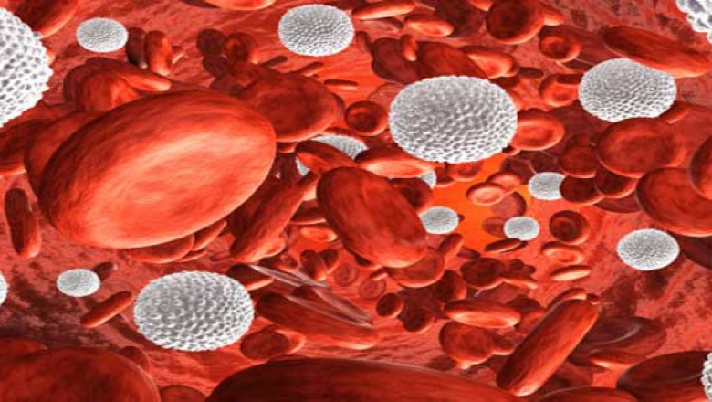 Aplastic Anemia Market to Grow Rapidly with Novel Immunosuppressive Therapies