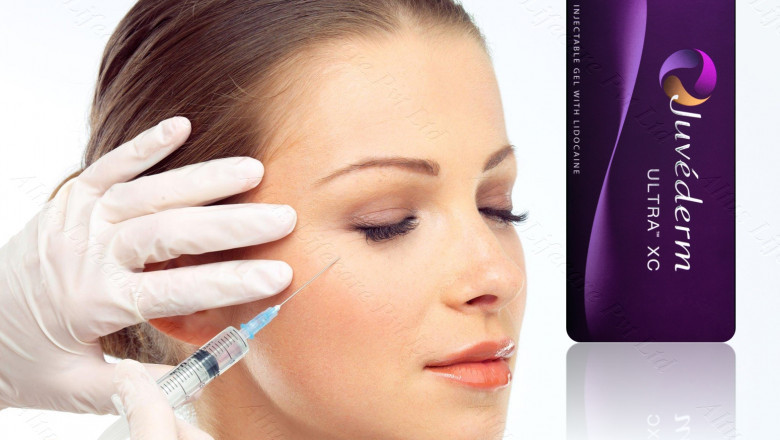 Juvederm Ultra XC Your Key to Redefining Beauty & Confidence!
