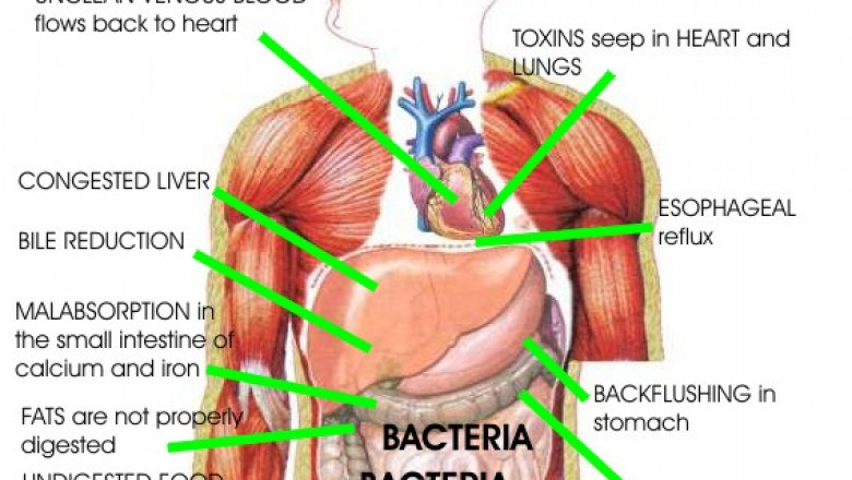 Natural remedies for gallstones at the Philadelphia Holistic Clinic