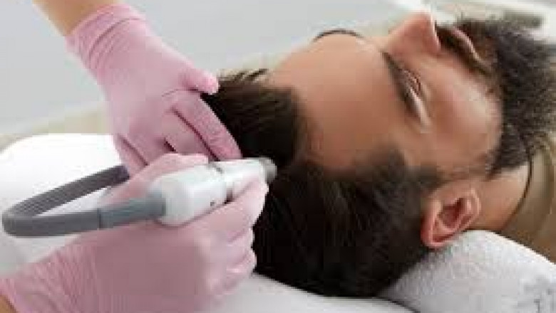 Top Non-Medical Hair Restoration Options: Natural Solutions That Work