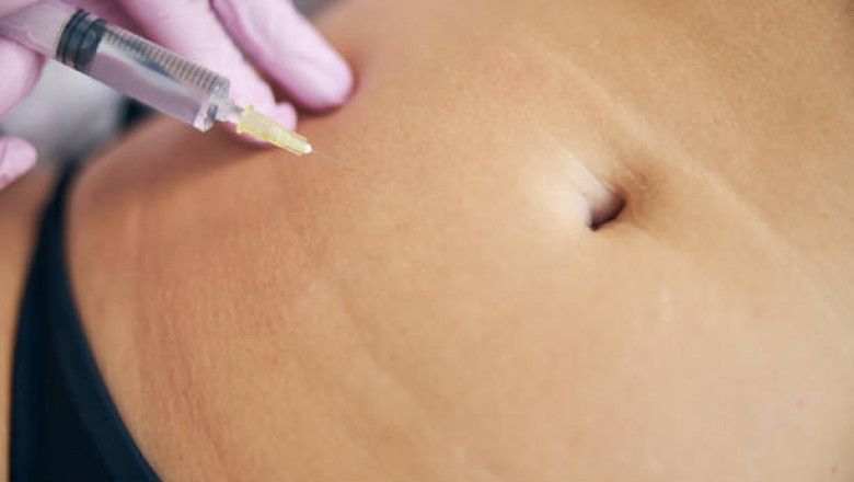 Fat Dissolving Injections in Dubai: What to Expect Before