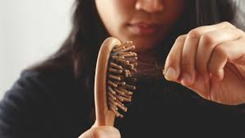 Natural Hair Health Remedies You Can Start Today to Prevent Hair Loss