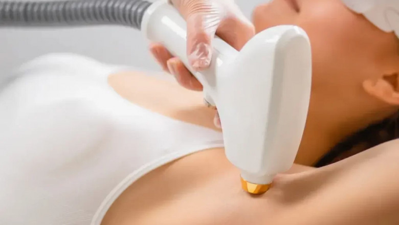 Stay Razor-Free with Laser Hair Removal Cost in Dubai