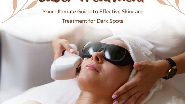 Your Ultimate Guide to Effective Skincare Treatment for Dark Spots