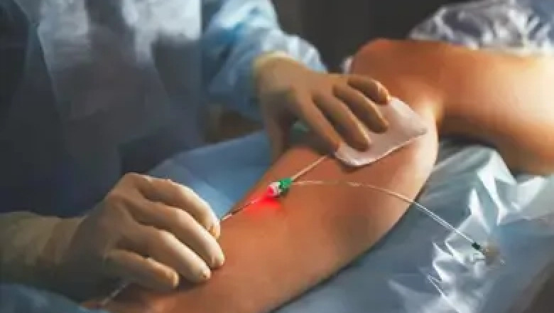 Best Varicose Veins Specialist