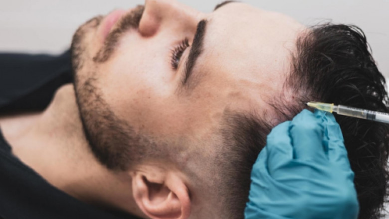 Can a Non-Surgical Hair Replacement Service Restore Your Hair Naturally?