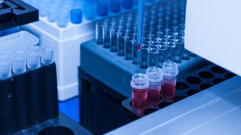 Non-Viral Transfection Reagents Market to Witness Growth on Electroporation Advances