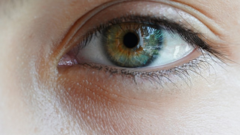 Recovery Tips After Cataract Surgery for Faster Healing