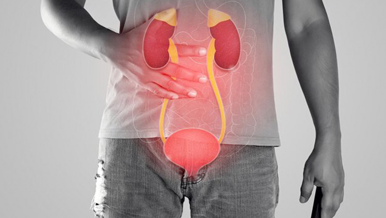 Urethral Stricture Symptoms &amp; Effective Management - Treatment for Urethral Stricture