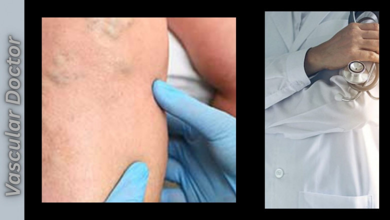 What Does a Vascular Doctor Do?