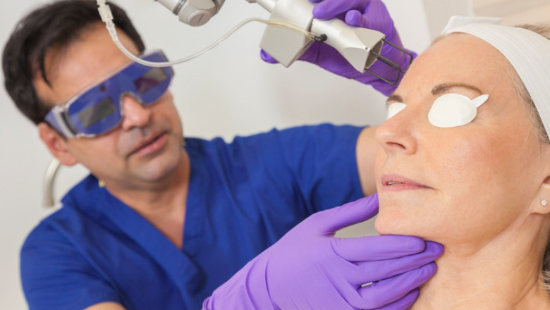 Get Clear Skin with This Fractional CO2 Laser Treatment Cost Plan