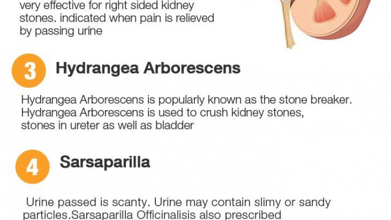 Kidney stones - Viva Healthy Life - The Center for Holistic Medicine